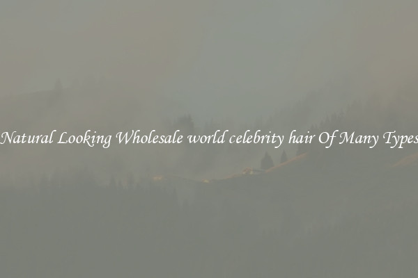 Natural Looking Wholesale world celebrity hair Of Many Types